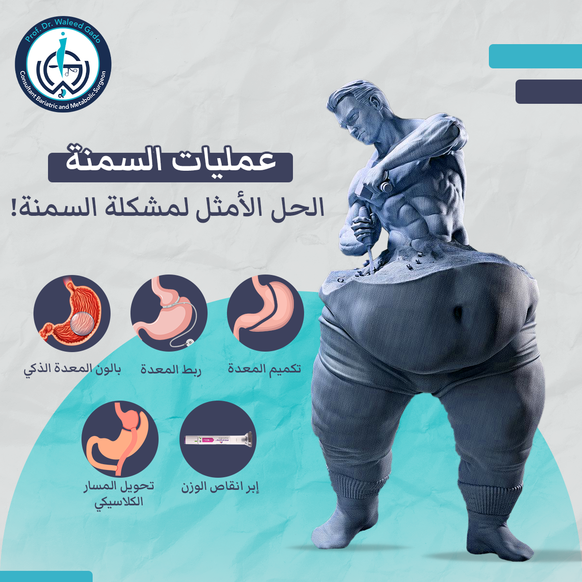 ​عمليات السمنة مختلفة و لها طرق ووسائل مختلفة ​
