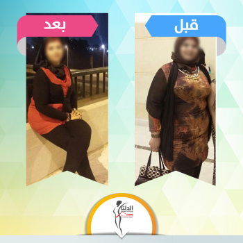 التغير قرار